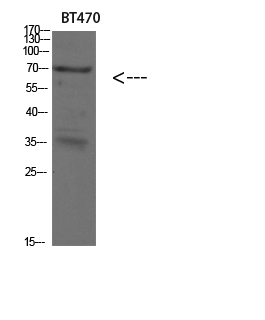 Western blot analysis of SKOV3 293T lysate, antibody was diluted at 500