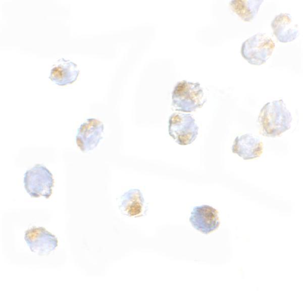 Immunocytochemistry of ORAI2 in Jurkat cells with ORAI2 antibody at 5 μg/mL
