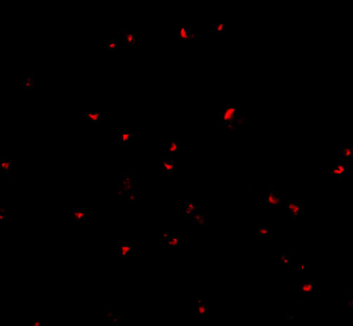 Immunofluorescence of ORAI2 in Jurkat cells with ORAI2 antibody at 20 μg/mL
