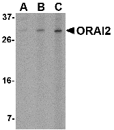 Western blot analysis of ORAI2 in Jurkat cell lysate with ORAI2 antibody at (A) 1, (B) 2 and (C) 4 μg/mL