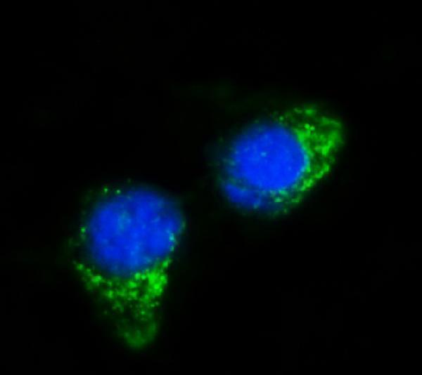 a07415 2 ifit5 primary antibodies if testing 5