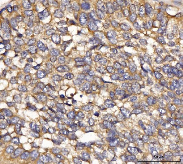  IHC analysis of IFIT5 using anti-IFIT5 antibody (A07415-2)