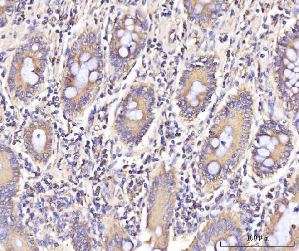 a07415 2 ifit5 primary antibodies ihc testing 4