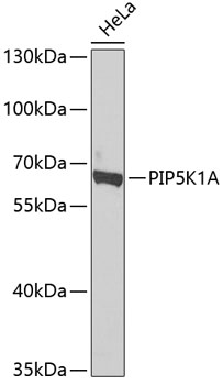 a07416 1 pip5k1a primary antiboties wb testing 1