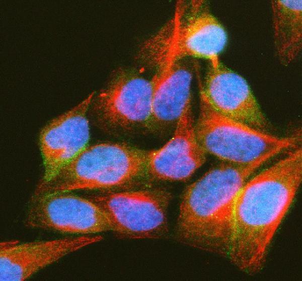 a07416 3 pip5k1a primary antibodies if testing 4