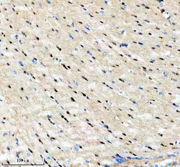  IHC analysis of PIP5K1A using anti-PIP5K1A antibody (A07416-3)