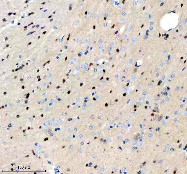 a07416 3 pip5k1a primary antibodies ihc testing 3