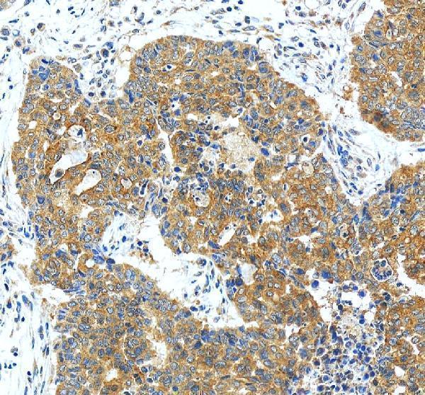 IHC analysis of PIP5K1A using anti-PIP5K1A antibody (A07416-3)