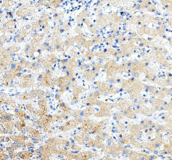 a07416 3 pip5k1a primary antibodies ihc testing 5