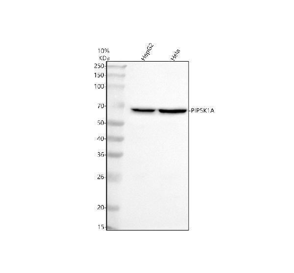  Western blot analysis of PIP5K1A using anti-PIP5K1A antibody (A07416-3)