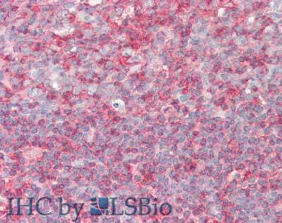 Immunohistochemistry of Rabbit anti-PIP5K1A antibody
