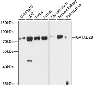 a07417 gatad2b primary antiboties wb testing 1