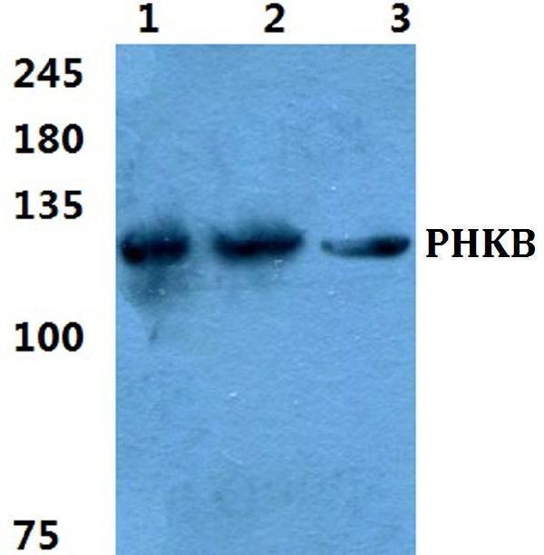 Western blot (WB) analysis of PHKB polyclonal antibody at 1:500 dilution
Lane1:Hela cell lysate
Lane2:sp2/0 cell lysate
Lane3:H9C2 cell lysate