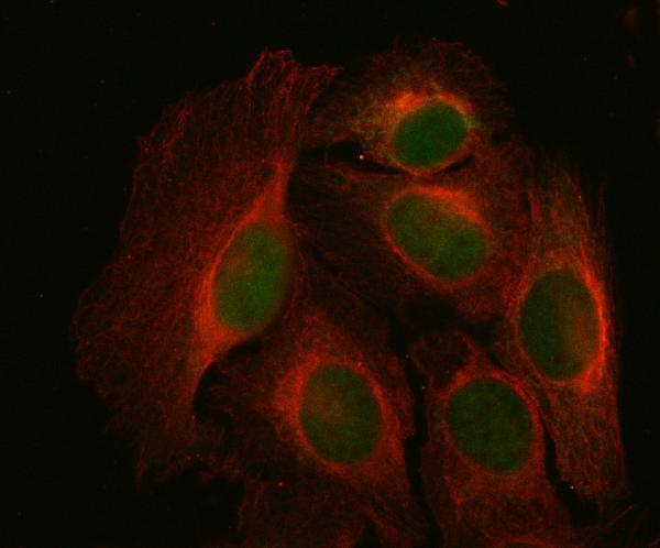 a07420 3 ndufa9 primary antibodies if testing 14