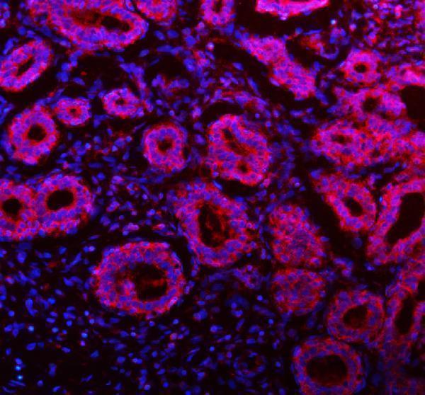 a07420 3 ndufa9 primary antibodies if testing 16