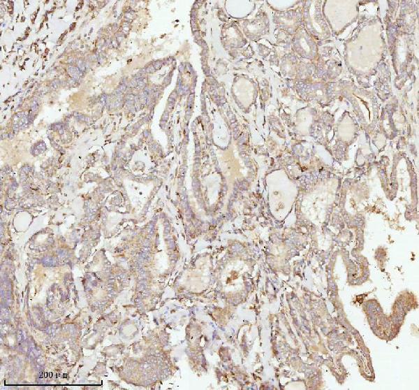 a07420 3 ndufa9 primary antibodies ihc testing 10
