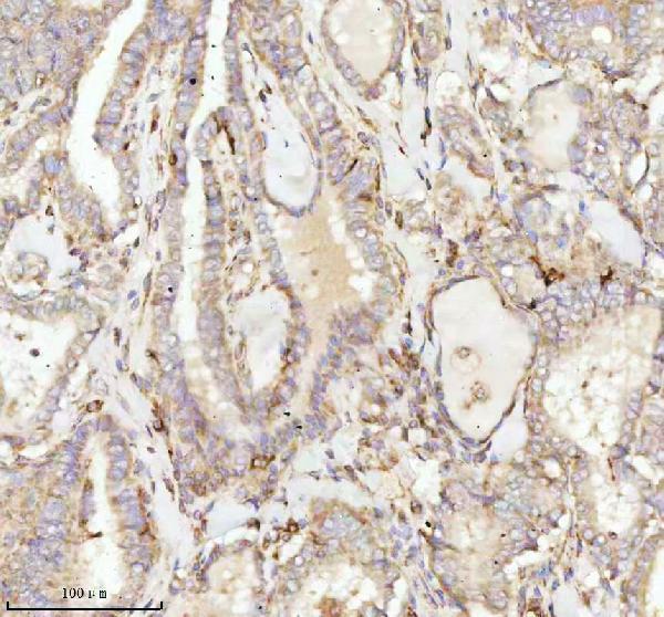 a07420 3 ndufa9 primary antibodies ihc testing 11