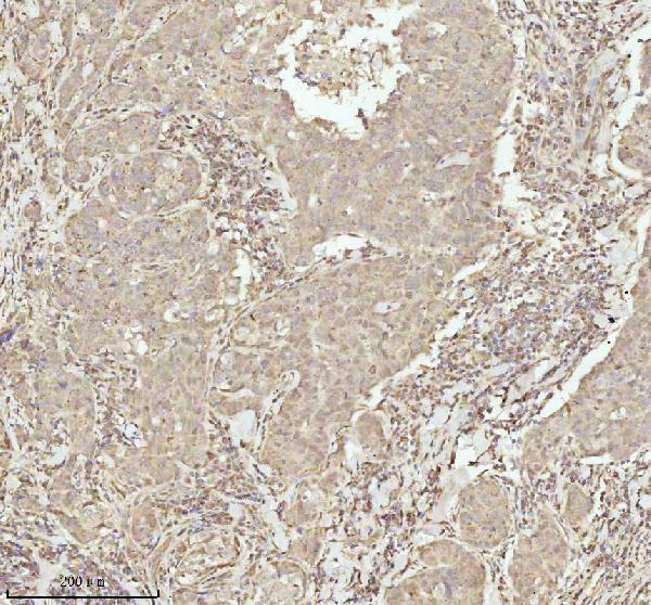  IHC analysis of NDUFA9 using anti-NDUFA9 antibody (A07420-3)