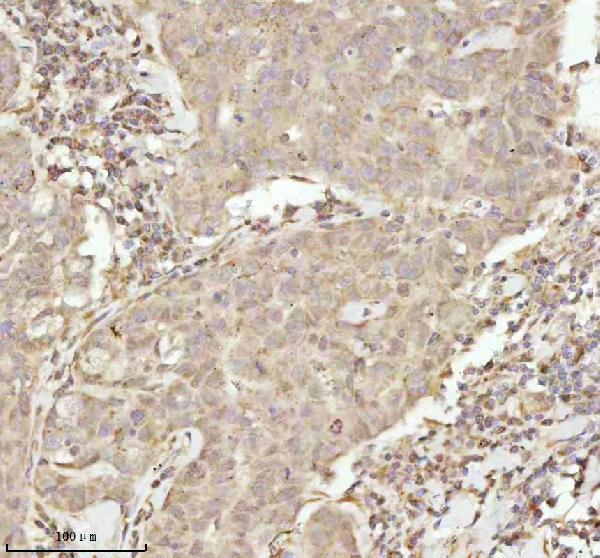 IHC analysis of NDUFA9 using anti-NDUFA9 antibody (A07420-3)