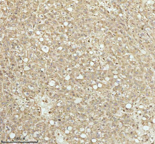 a07420 3 ndufa9 primary antibodies ihc testing 4