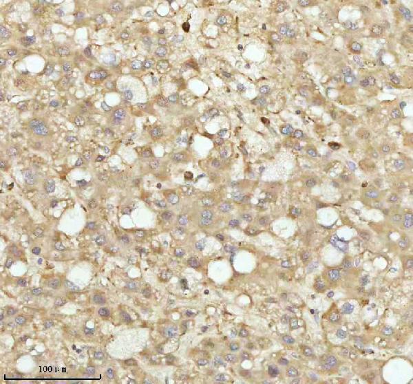 a07420 3 ndufa9 primary antibodies ihc testing 5