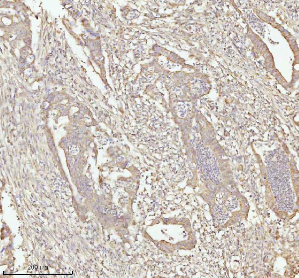 a07420 3 ndufa9 primary antibodies ihc testing 6