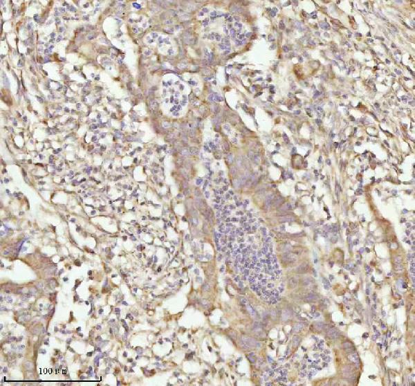 a07420 3 ndufa9 primary antibodies ihc testing 7