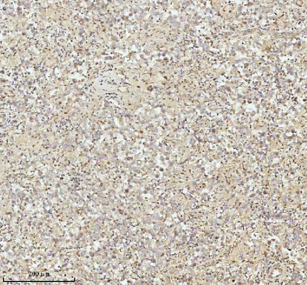 a07420 3 ndufa9 primary antibodies ihc testing 8
