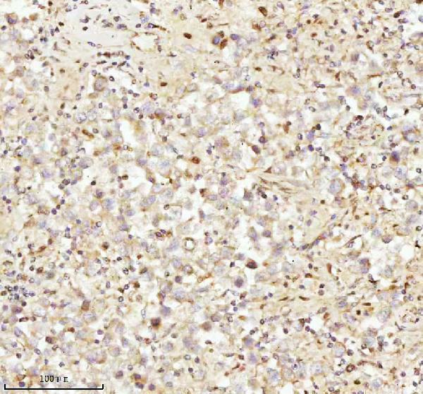 a07420 3 ndufa9 primary antibodies ihc testing 9