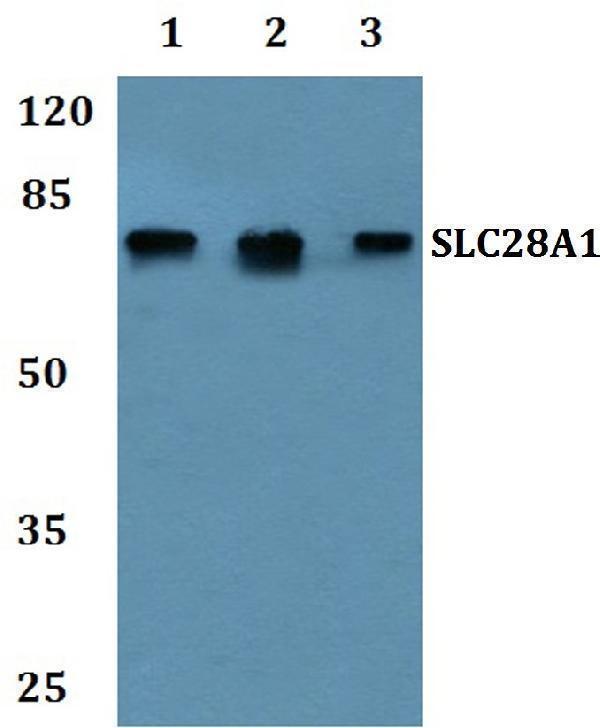 a07421 slc28a1 primary antiboties wb testing 1