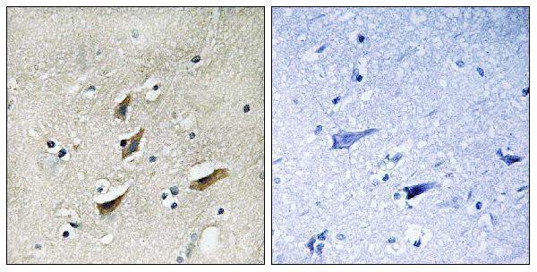 a07422 dmtn primary antibodies ihc testing 4