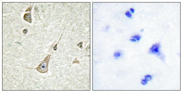 a07423 pcdh11y primary antibodies ihc testing 2