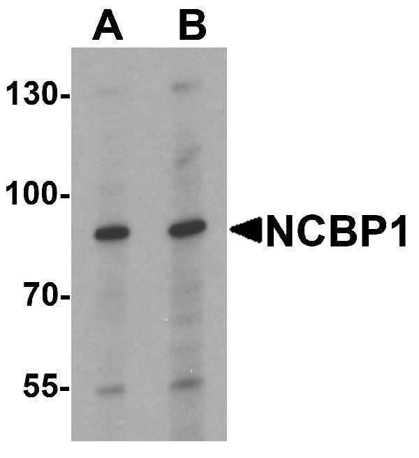 a07424 1 ncbp1 primary antibodies wb testing 1