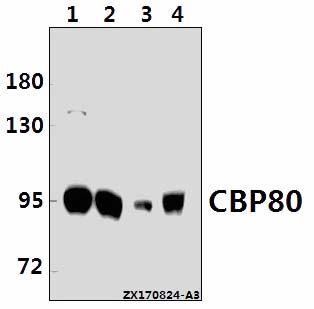 Western blot (WB) analysis of CBP80 (R5) pAb at 1:500 dilution
Lane1:K562 whole cell lysate(10ug)
Lane2:Hela whole cell lysate(20ug)
Lane3:The Brain tissue lysate of Mouse(40ug)
Lane4:The Brain tissue lysate of Rat(40ug)