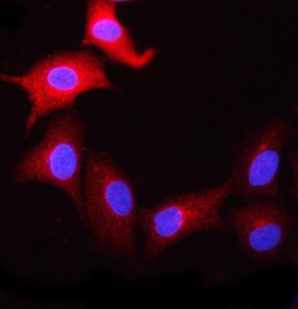 a07424 3 ncbp1 primary antibodies if testing 11