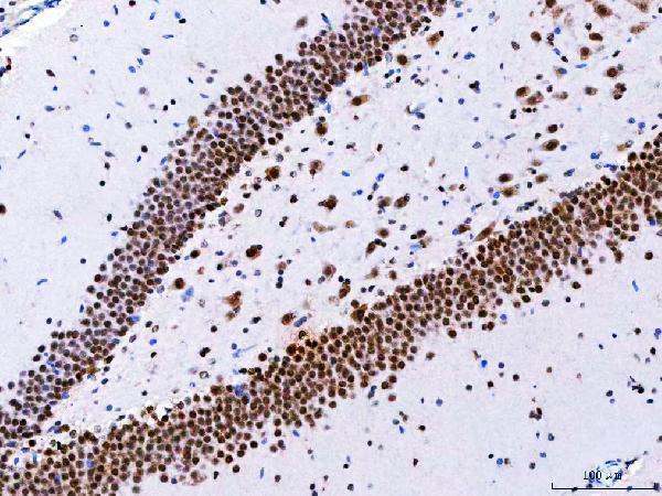 a07424 3 ncbp1 primary antibodies ihc testing 10
