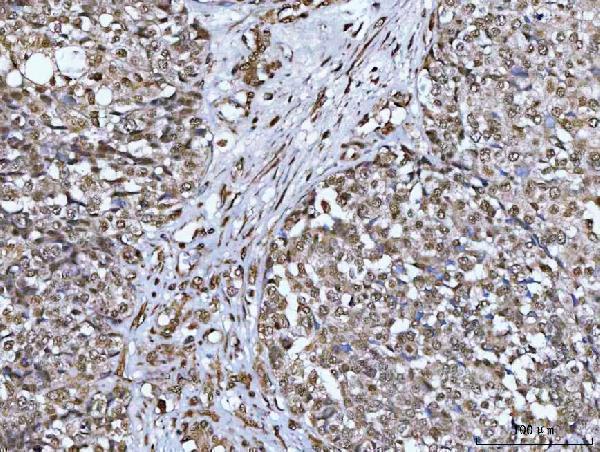  IHC analysis of NCBP1 using anti-NCBP1 antibody (A07424-3)