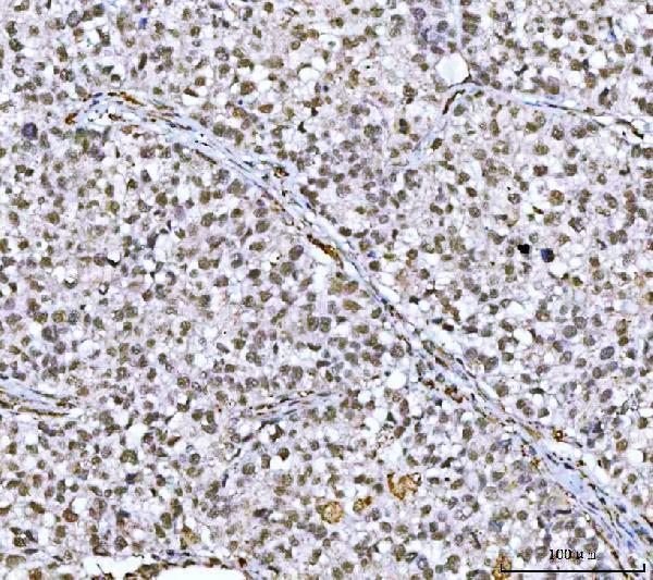  IHC analysis of NCBP1 using anti-NCBP1 antibody (A07424-3)