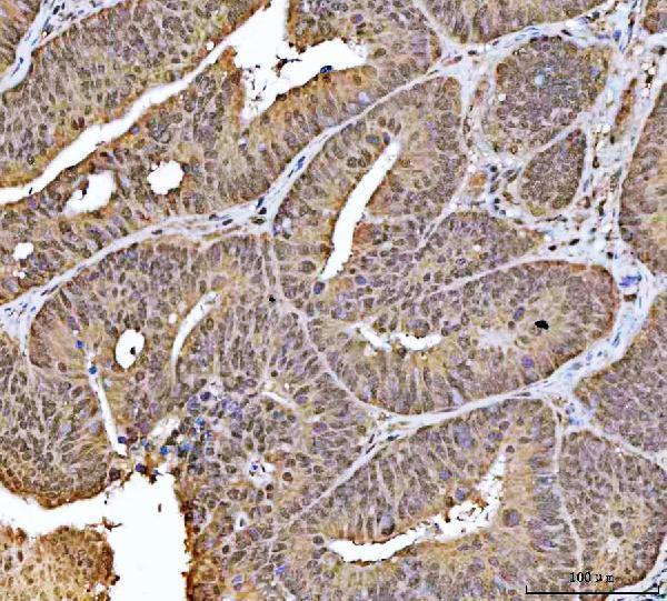 a07424 3 ncbp1 primary antibodies ihc testing 4