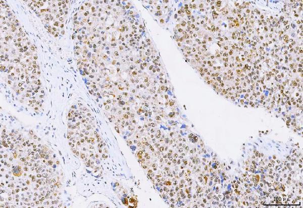 a07424 3 ncbp1 primary antibodies ihc testing 5_1