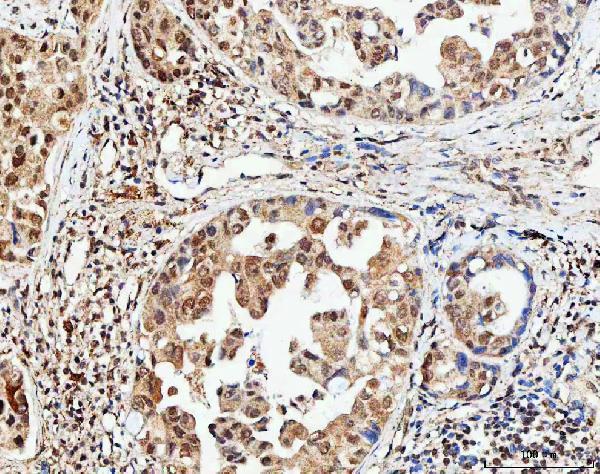 a07424 3 ncbp1 primary antibodies ihc testing 6_1