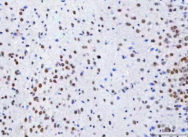a07424 3 ncbp1 primary antibodies ihc testing 8_1