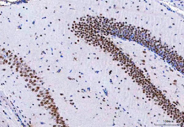a07424 3 ncbp1 primary antibodies ihc testing 9