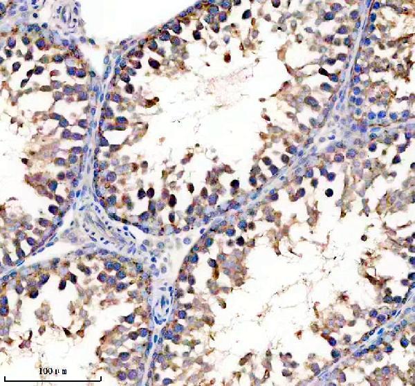 a07427 1 ube2g2 primary antibodies ihc testing 1