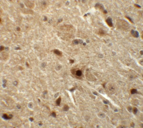 a07429 nkx3 2 primary antibodies ihc testing 2