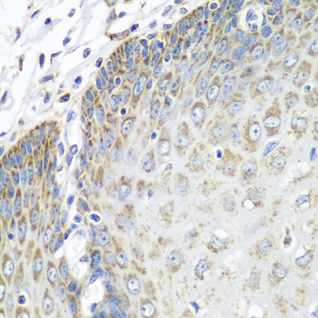 Immunohistochemistry of paraffin-embedded human esophagus using TMOD3 antibody  at dilution of 1:100 