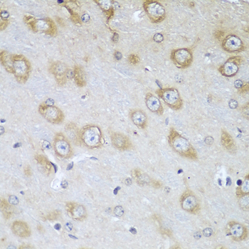 Immunohistochemistry of paraffin-embedded mouse brain using TMOD3 antibody  at dilution of 1:100 