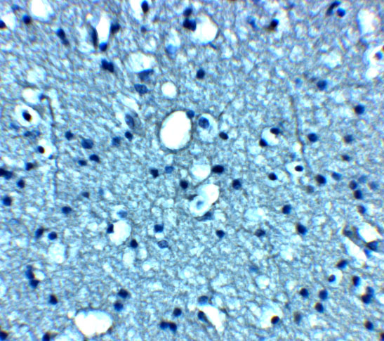 Immunohistochemistry of VTI1b in human brain tissue with VTI1b antibody at 5 μg/mL