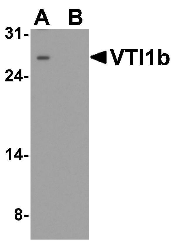 Western blot analysis of VTI1b in HeLa cell lysate with VTI1b antibody at 1 μg/ml in (A) the absence and (B) the presence of blocking peptide