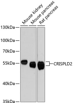 a07439 crispld2 primary antiboties wb testing 1